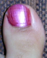 Attached picture 25-toe.jpg